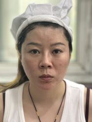 -烟台曙光医疗美容医院