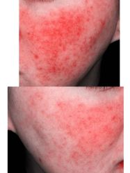 -和颜一美轻医美连锁