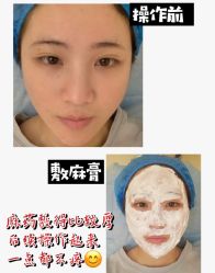 体验前-南宁华美医疗美容医院