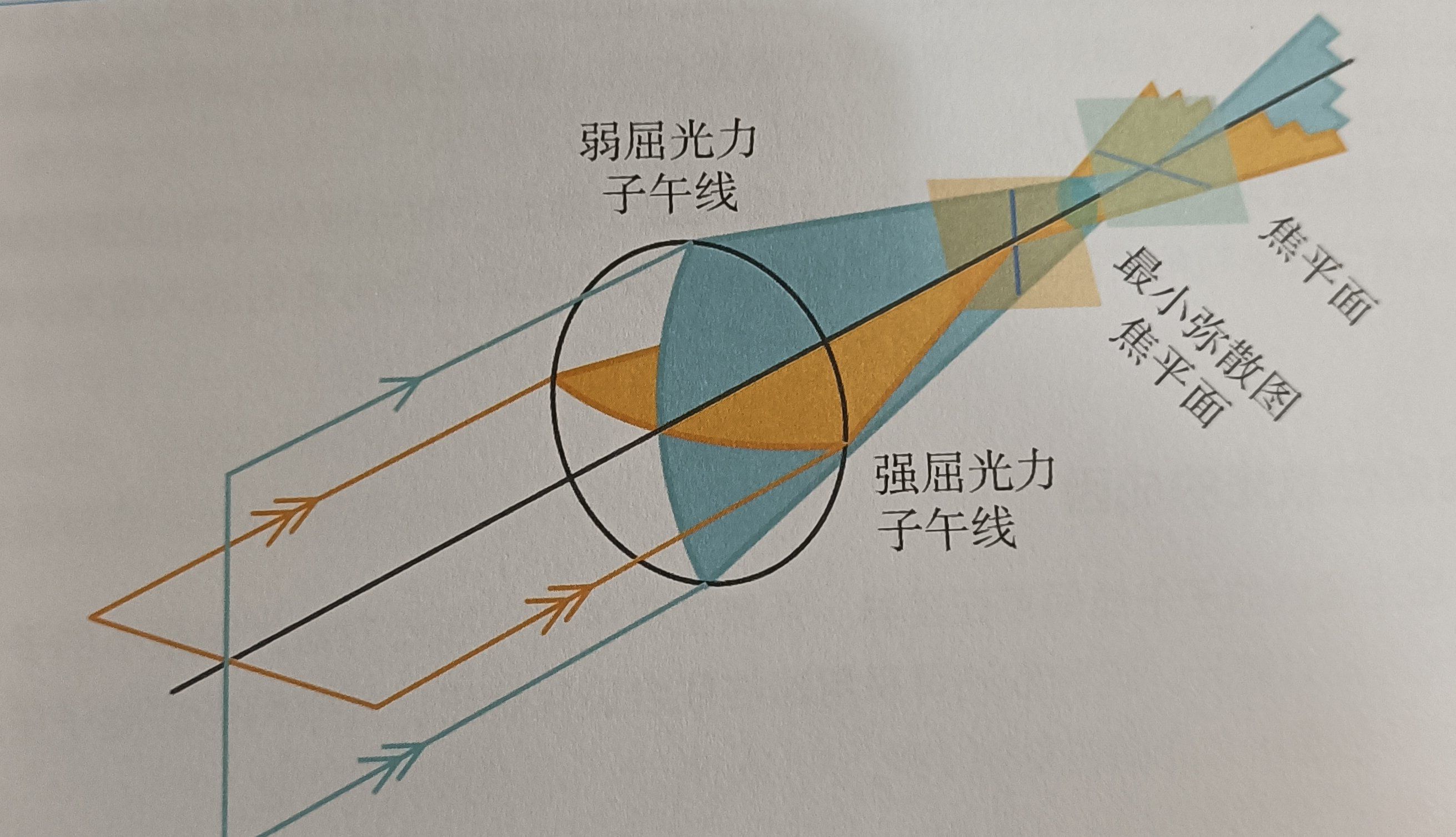 角膜散光为最常见的散光类型,表现为角膜在不同子午线上曲率有差异,并