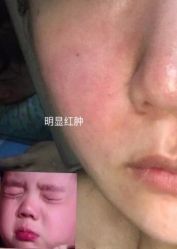-一美医疗美容