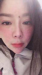 体验后-洁铭新加坡医美