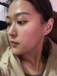 -天津健丽·去眼袋医疗美容机构