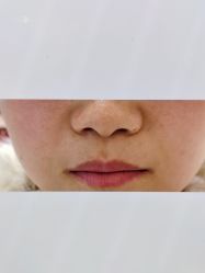 -Yestar 嘉兴艺星医疗美容医院