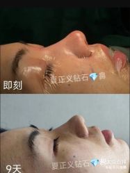 -北京米扬丽格医疗美容·联合丽格鼻整形中心