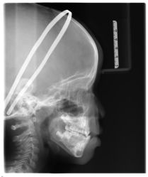 -青苗儿童口腔(长楹天街购物中心)