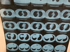 -华中科技大学同济医学院附属同济医院(汉口院区)