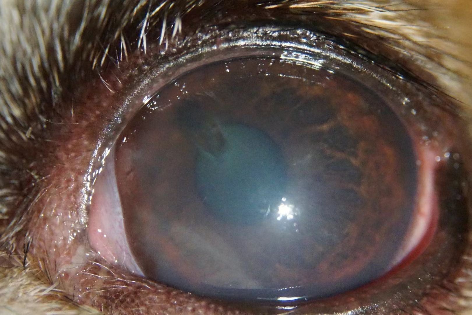 该病例通过我院诊断为基质层溃疡 细菌性角膜炎