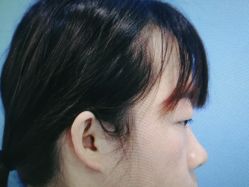 体验前-西安壹加壹医疗美容·西北抗衰旗舰店