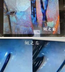 -希梵尔头皮抗衰·科技养发