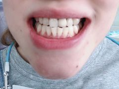 -Dr.Z dental仁康种植矫正中心