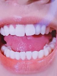 -瑞丽口腔·美学矫正中心