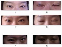 1-10天-上海华安整形外科门诊部