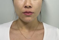 体验前-南京康美美容医院·旗舰店