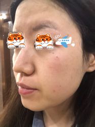 体验前-坤如玛丽·医疗美容中心