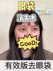 -天津健丽·去眼袋医疗美容机构