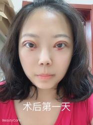 -八大处整形