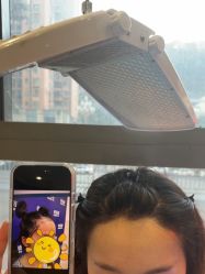 -碧莲盛·不剃发植发