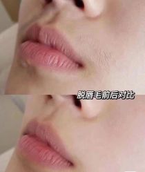 -中科妍美专业脱毛美肤连锁机构