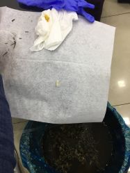 点击看大图 -德哥灰指甲脚气甲沟炎跖疣护理