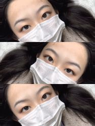 点击看大图 -杨益美学·野生眉半永久纹眉发际线