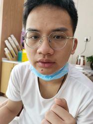 体验后-坤如玛丽·医疗美容中心
