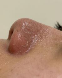 -skin79皮肤管理中心