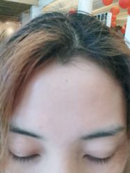 -铂特丽医美·眼鼻整形·光电美肤·注射抗衰