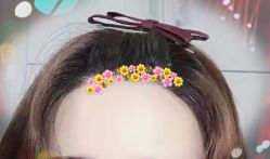 -大麦微针植发全国连锁