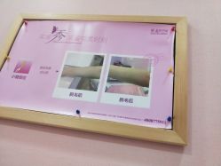 点击看大图 -晶奕空间专业脱毛连锁机构