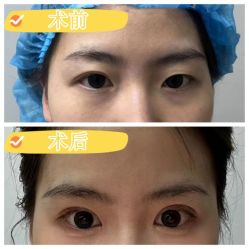 -素美医疗美容·西南眼鼻整形·修复基地