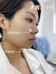 -上海时光整形外科医院