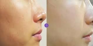 -SKINIST丽铂医疗美容
