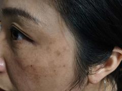 -上海爱以德护理院·康复(宝山院)