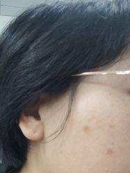 -洁铭新加坡医美