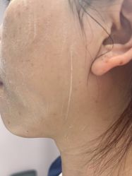-美瑞莎创美医疗美容