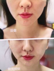 -和颜一美轻医美连锁