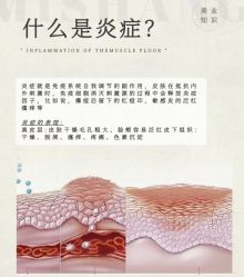 点击看大图 -玛莲朵·海菲秀冰珀科