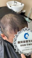 -唐风采假发补发定制