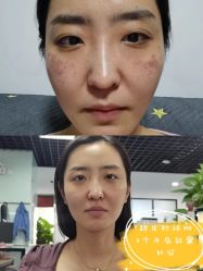 -小忠丽格医美