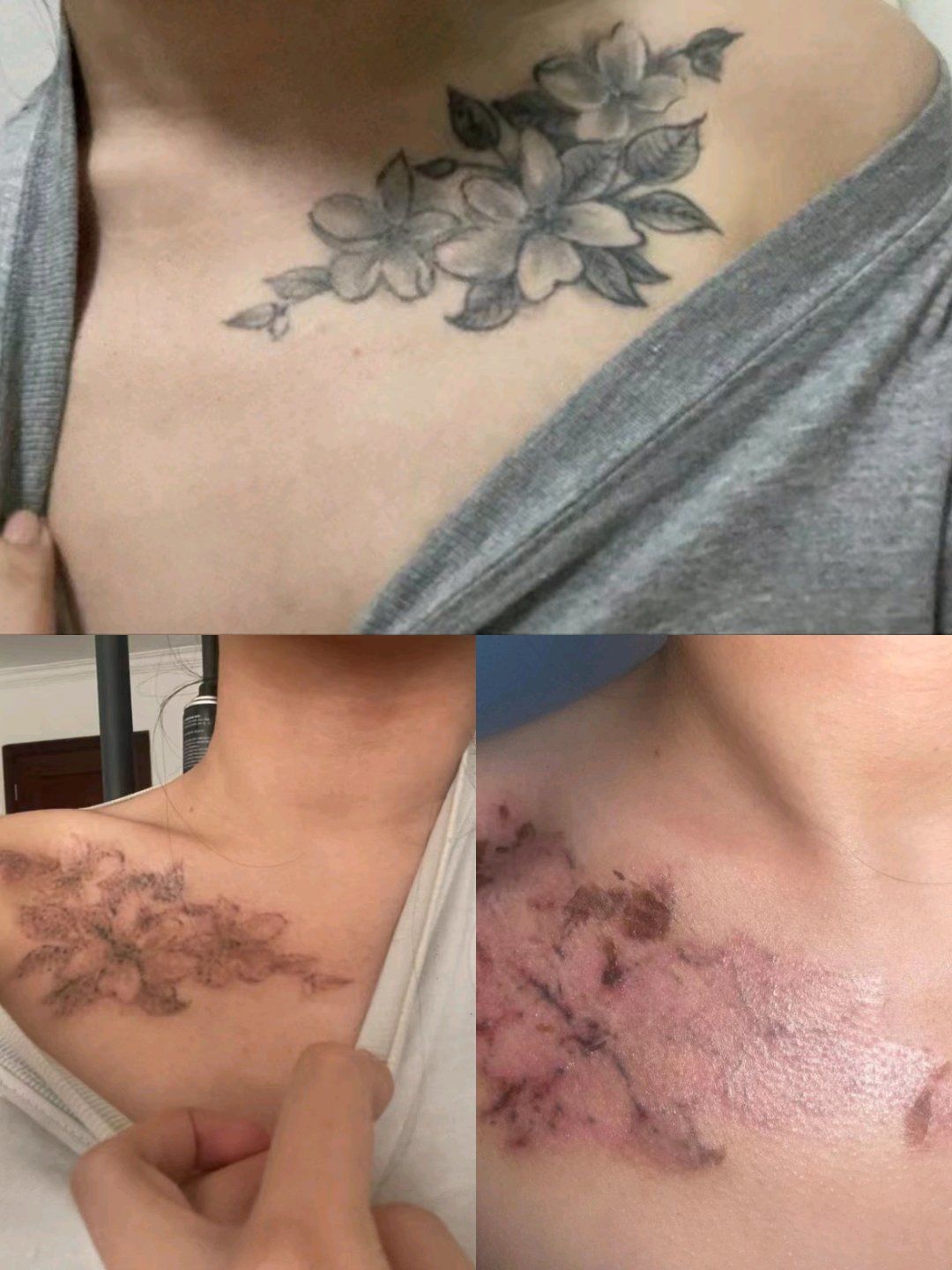 这次洗纹身一点都不后悔