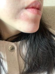 体验后-重庆军美医疗美容医院