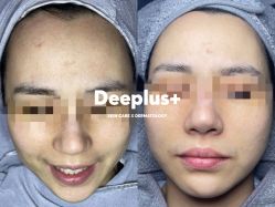 点击看大图 -Deeplus+韩国皮肤管理한국피부관리·C:Lab肌肤实验室