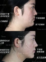 点击看大图 -Yestar重庆艺星医疗美容医院