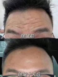 -资医堂·除疤祛痘祛斑