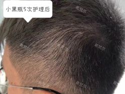 -希梵尔头皮抗衰·科技养发