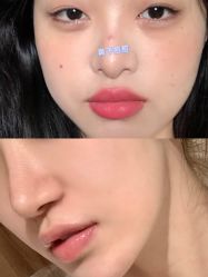 -成都西区医院整形美容