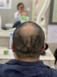 -唐风采假发补发定制