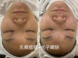 -LUNA皮相美·骨相美高级美感