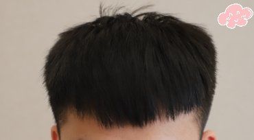 -大麦微针植发丨全国连锁